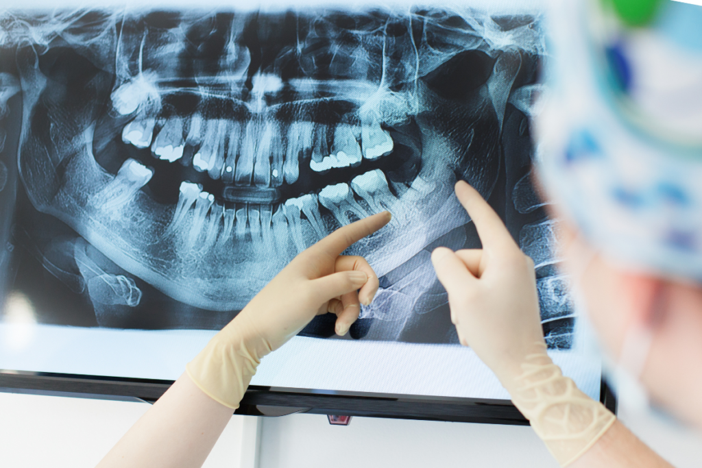 A dentist and a patient are pointing at the dental X-ray results