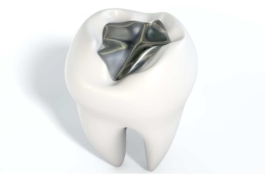 a dental fillings tooth model