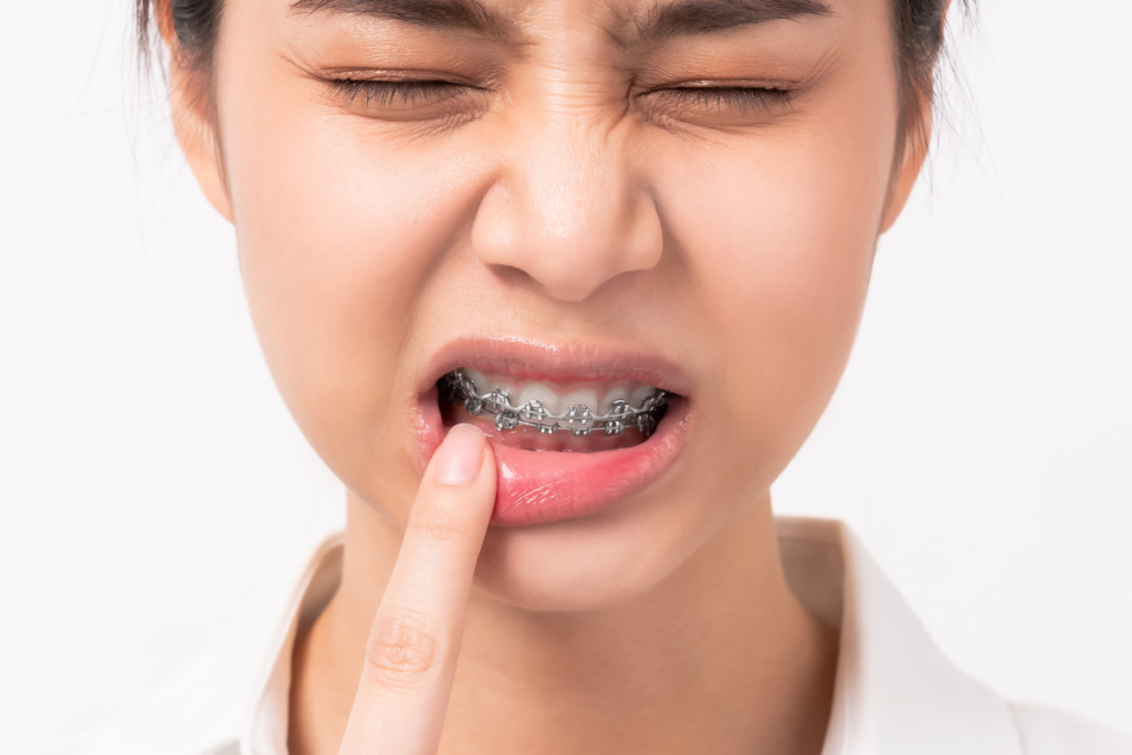 A woman is experiencing discomfort from her teeth braces